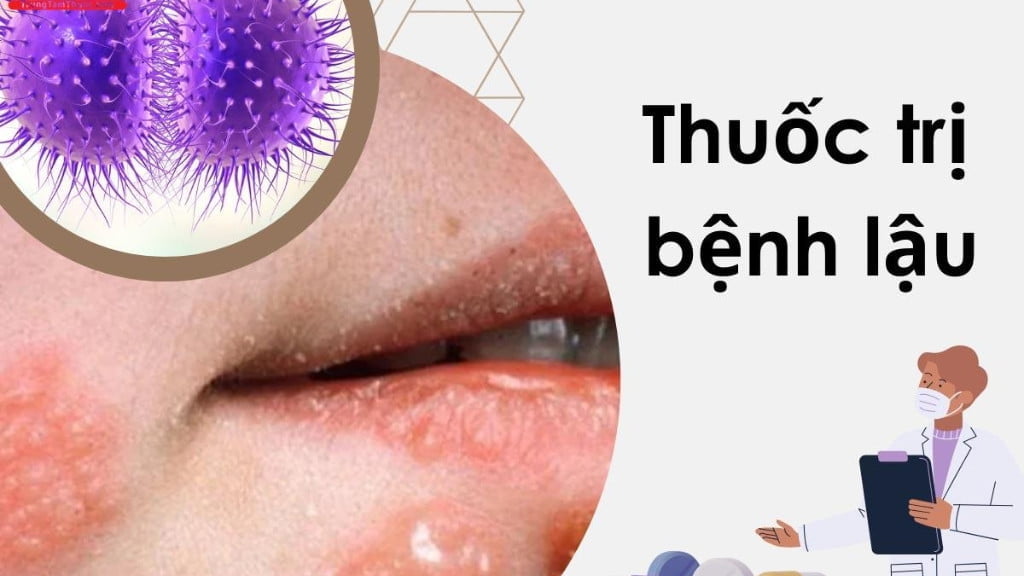Bệnh lậu - Căn bệnh xã hội phổ biến