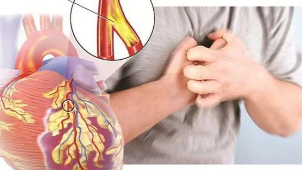 Nhận biết nguyên nhân và điều trị đau thắt ngực