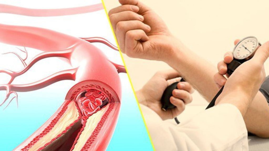 Những biến chứng nguy hiểm của bệnh tăng huyết áp