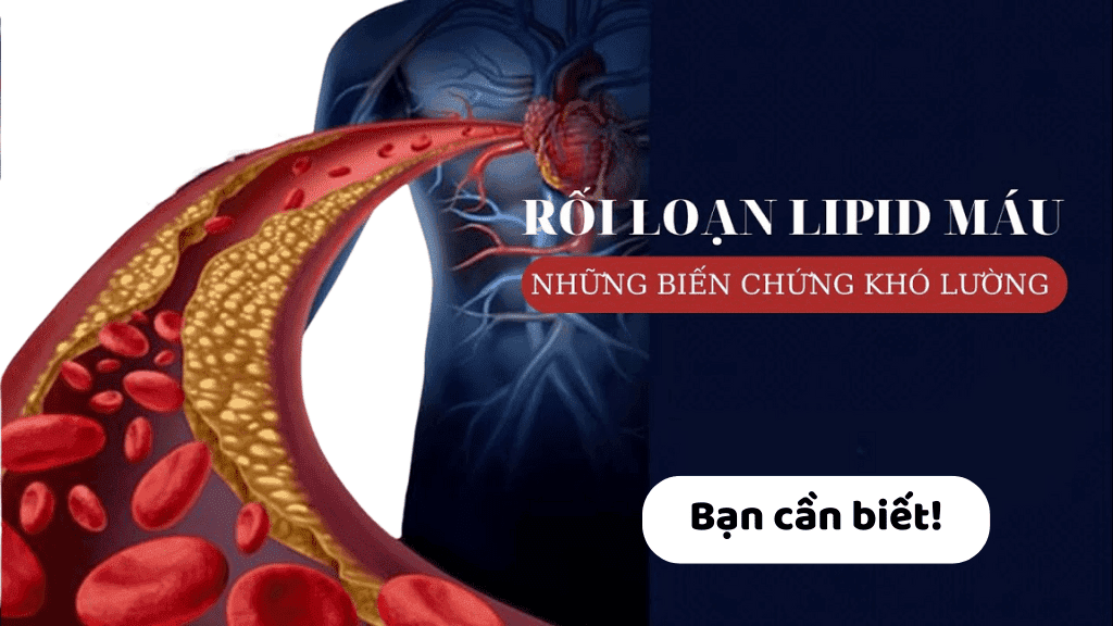 Rối loạn mỡ máu và các biến chứng nguy hiểm