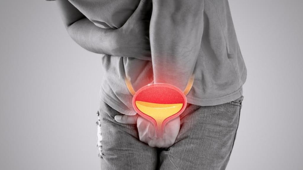Tăng sinh tiền liệt tuyến là gì?