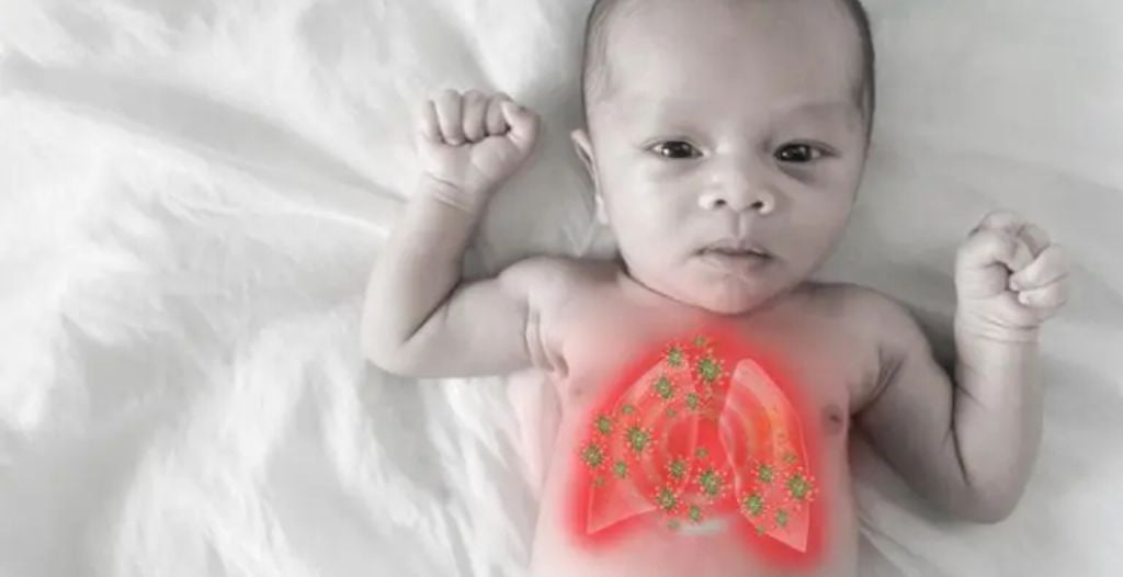 Cảnh báo những dấu hiệu viêm phổi ở trẻ sơ sinh