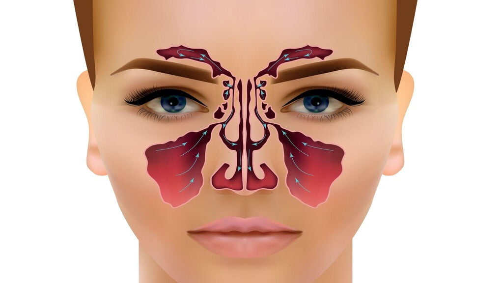 Tổng quan về phẫu thuật nội soi viêm xoang