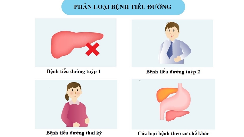 Các phân loại bệnh tiểu đường