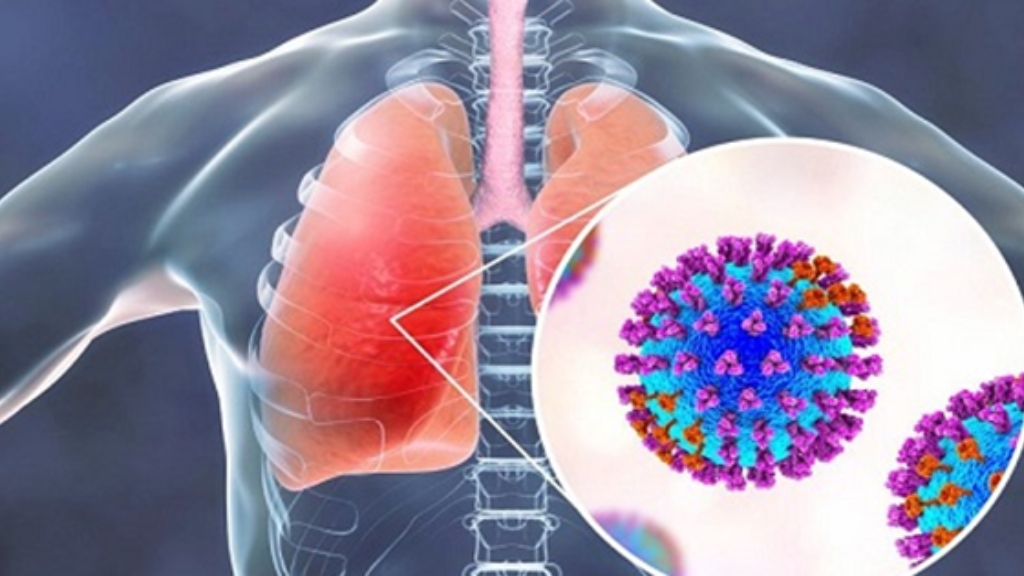 Vi khuẩn xâm nhập gây hại cho phổi