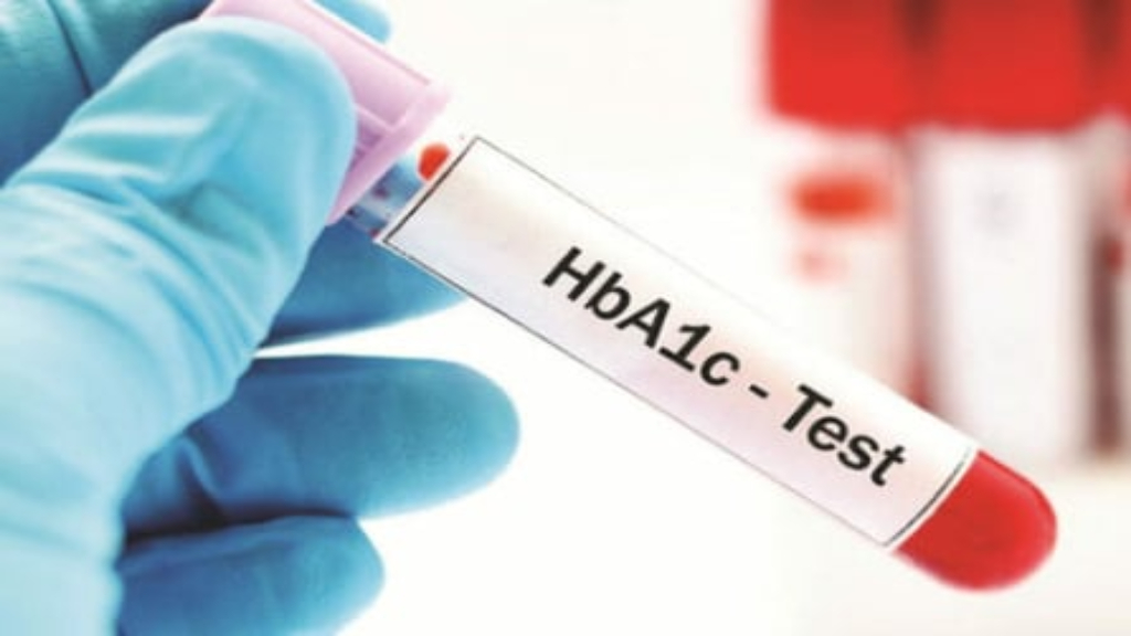 Ý nghĩa chỉ số HbA1c trong điều trị đái tháo đường