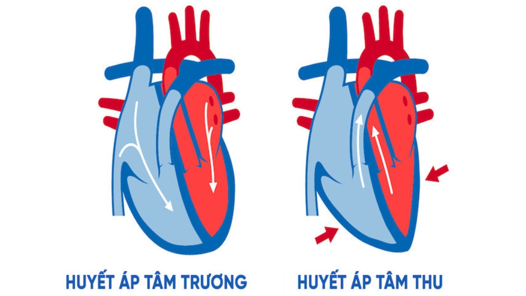 Huyết áp có 2 trị số chính là tâm thu và tâm trương