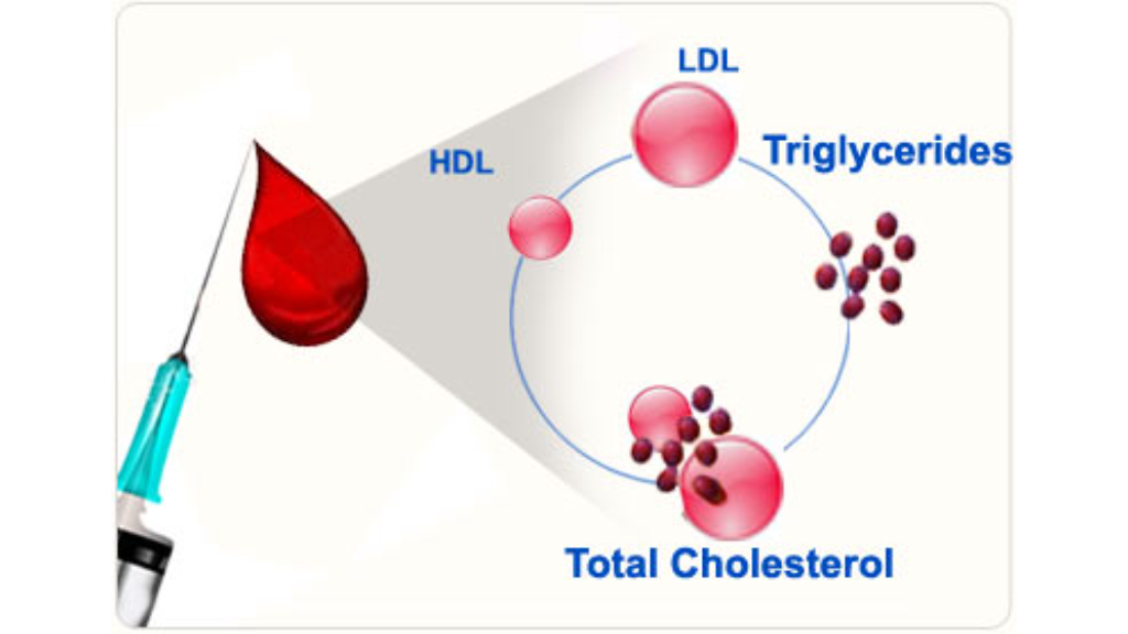 Các xét nghiệm chẩn đoán rối loạn lipid máu