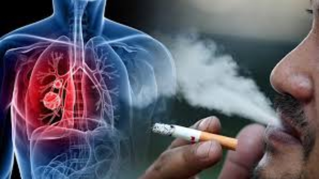 Hút thuốc lá nguyên nhân gây tăng áp phổi