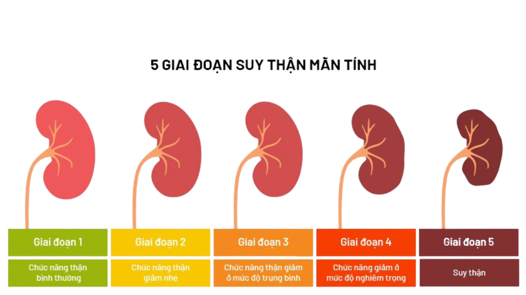 Phân loại 5 mức suy thận mạn tính