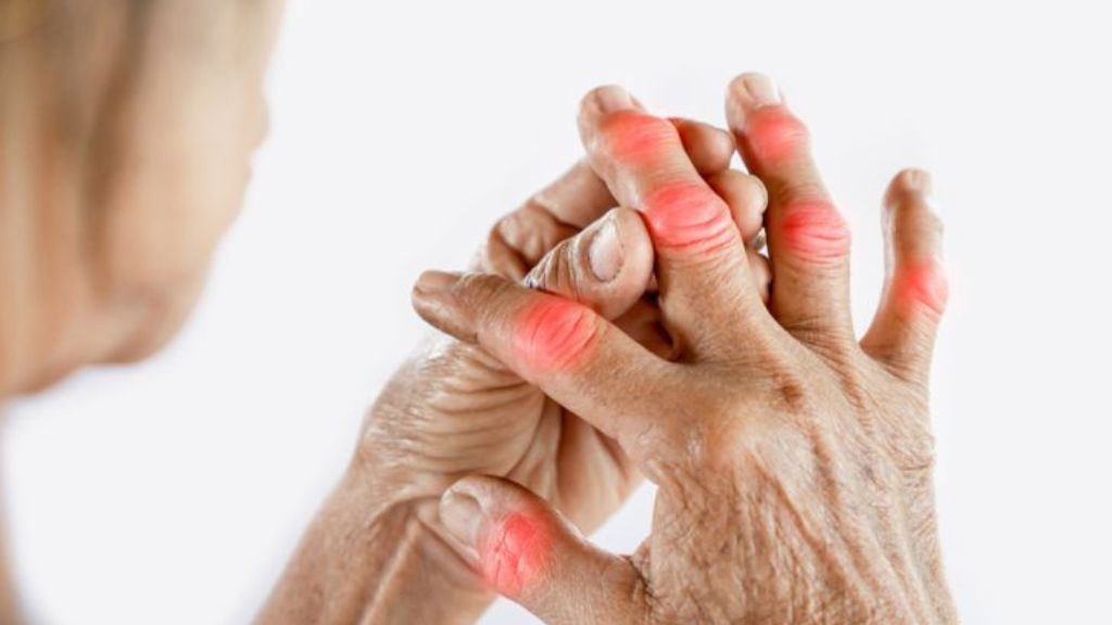 Viêm khớp dạng thấp gây viêm và tổn thương các khớp