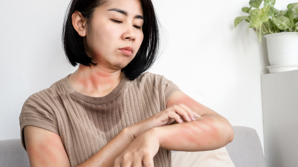 Tìm hiểu về những kiến thức liên quan đến tình trạng viêm da dị ứng