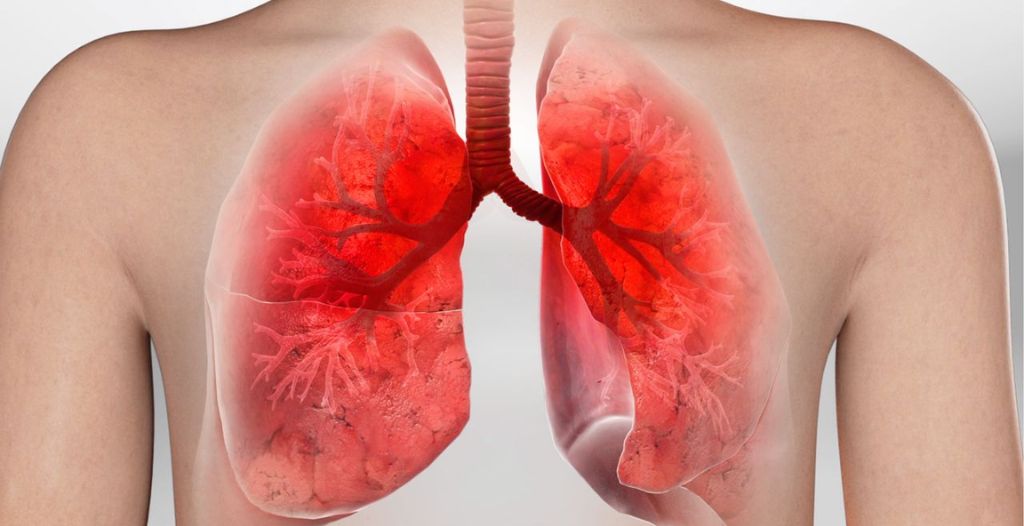 Mọi độ tuổi đều có thể mắc bệnh viêm phế quản