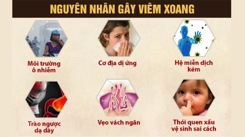 Những Nguyên Nhân Phổ Biến Gây Viêm Xoang